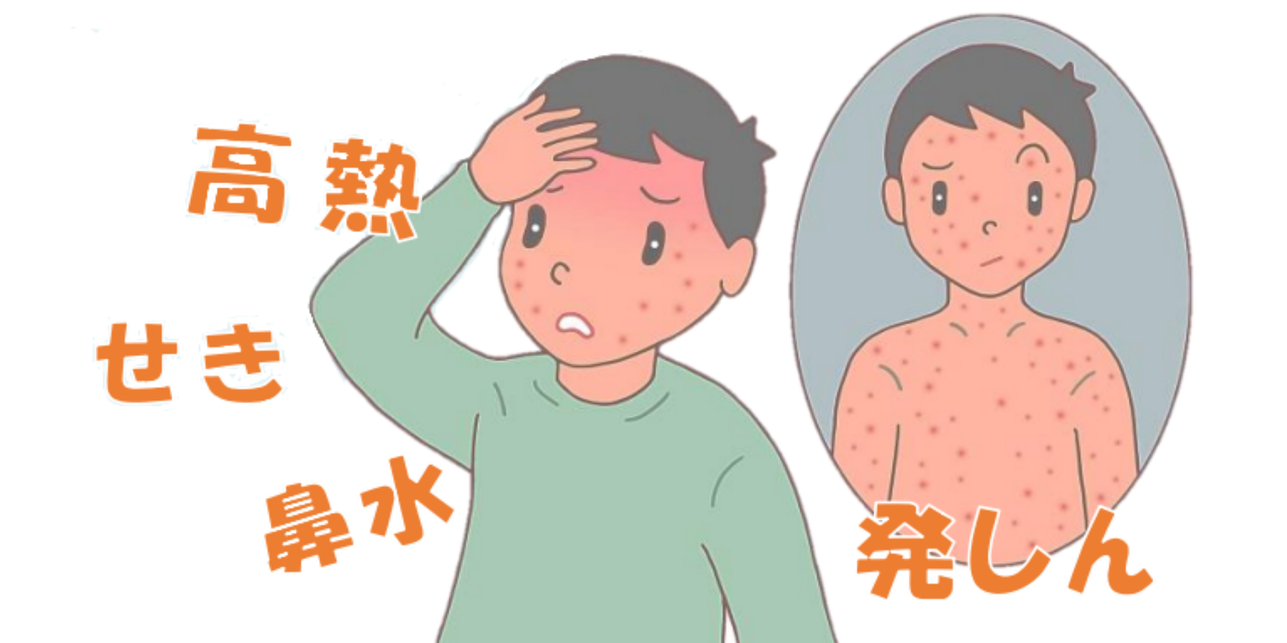 岐阜市で麻しん(はしか)のご相談 | 予防接種・抗体検査 | いろはなクリニック